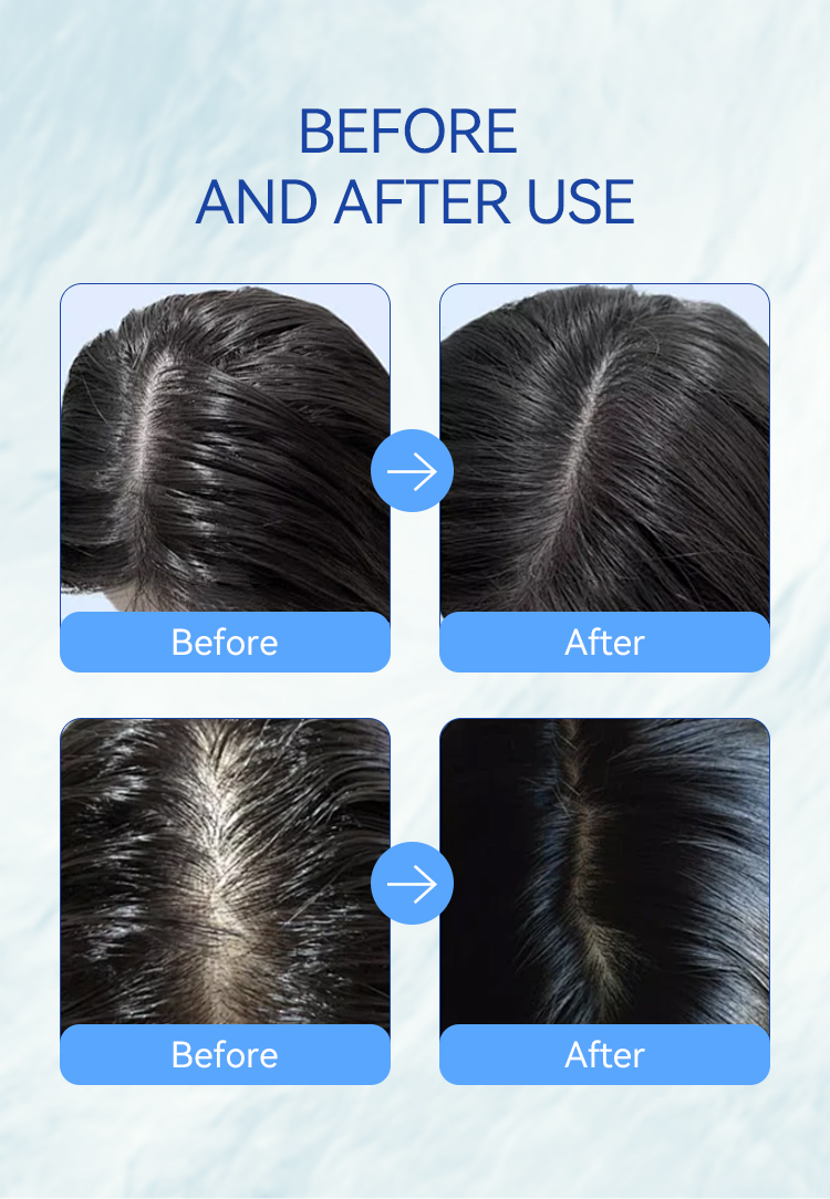 MUSK&reg;-750-蓝色款_08 